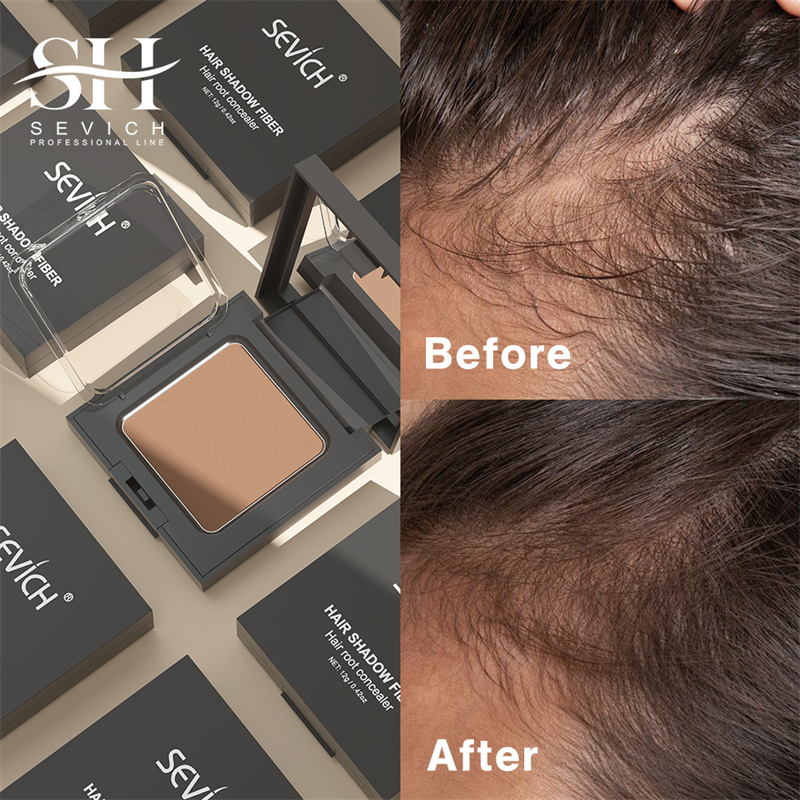 SEVICH 12g Hairline Powder Wit - Rooting Hormone Powder 리뷰 및 가격