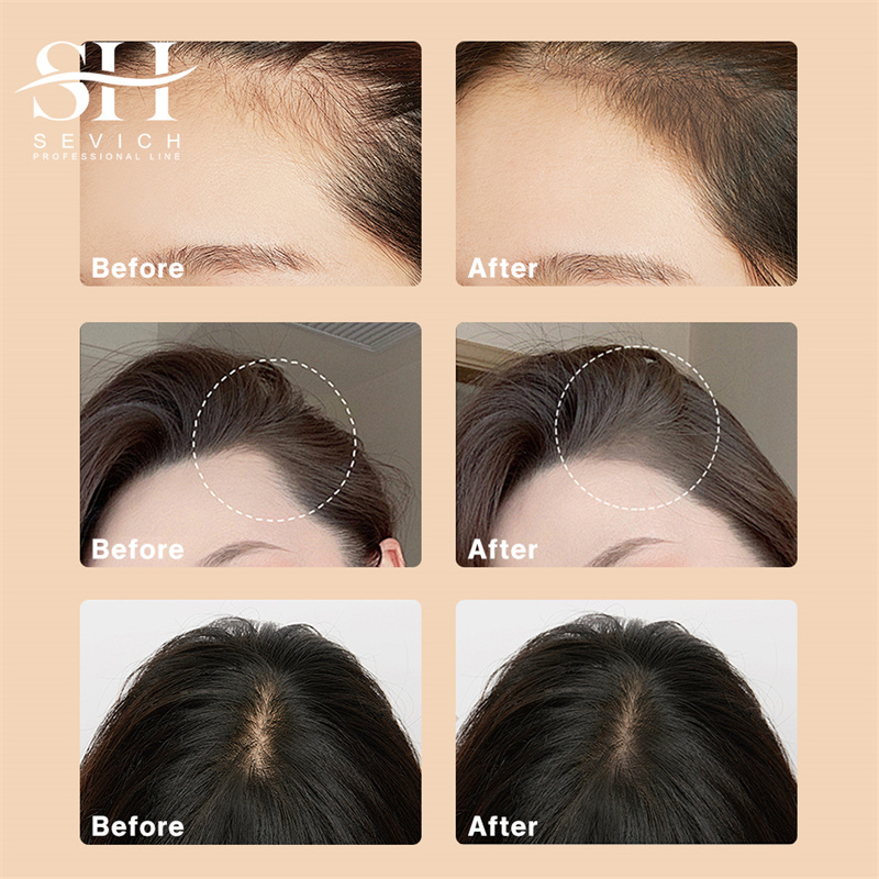 SEVICH 12g Hairline Powder Wit - Rooting Hormone Powder 리뷰 및 가격